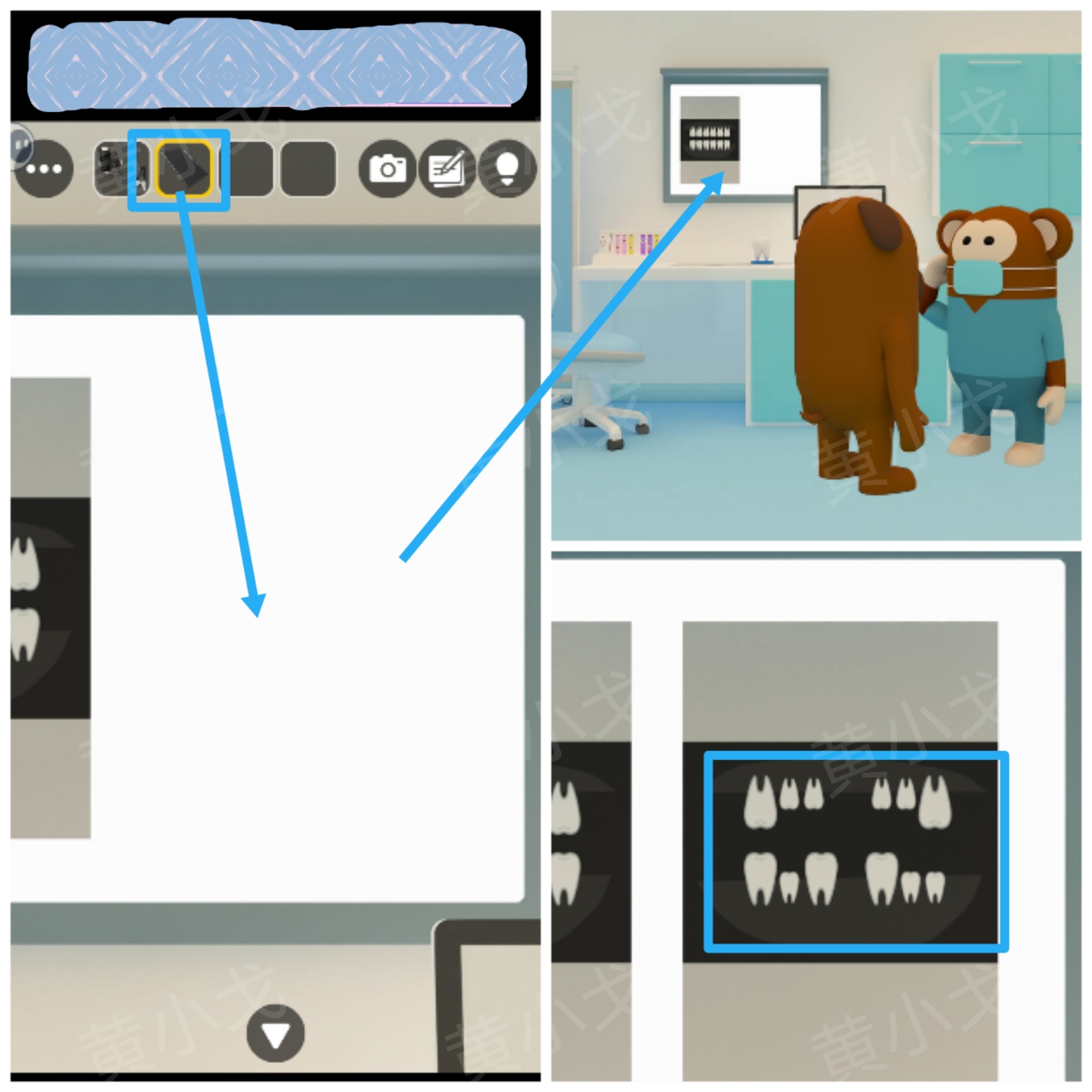 Escape Room：Dental（密室逃脱：牙科诊所）攻略（二）